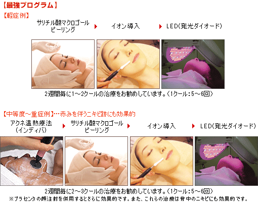 ニキビ撃退最強プログラム