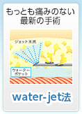 water-jet法